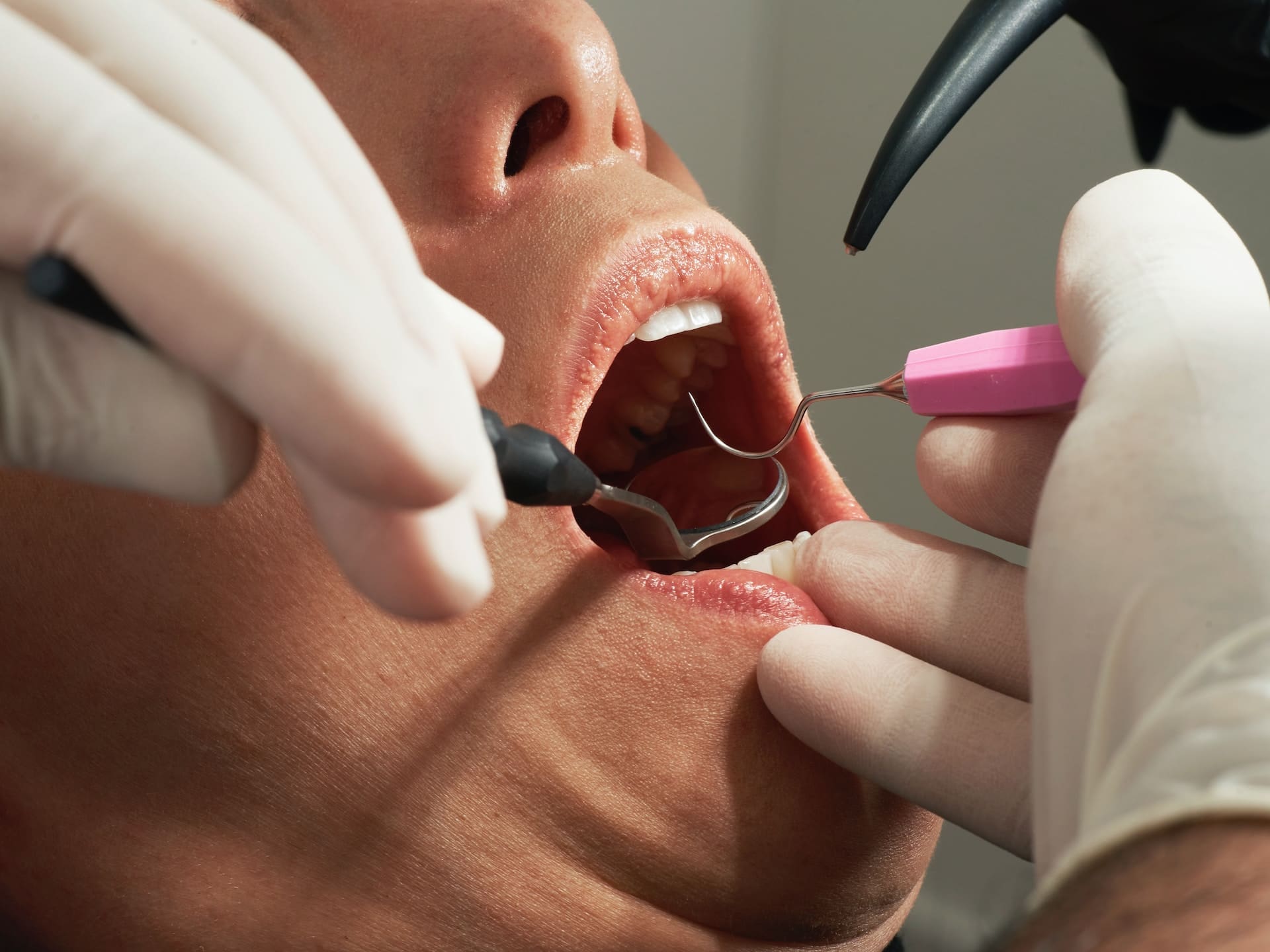 Patient receiving Restorative Dentistry in Danvers.