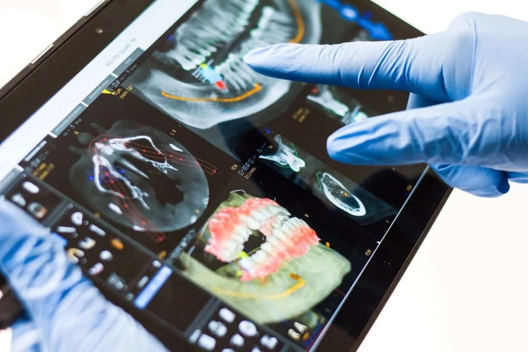 Dentist reviewing X-ray on a tablet